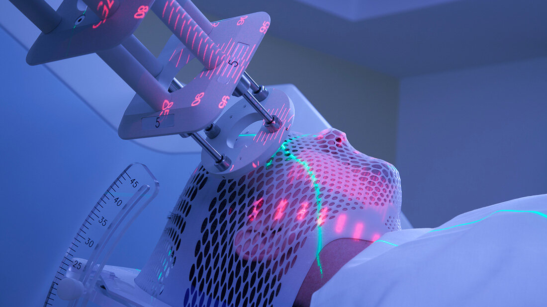 Strahlentherapie_Kopffixierung.jpg Fixierung Strahlentherapie