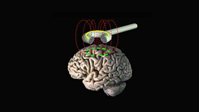 transkranielle_Magnetstimulation_VonEric_Wassermann_M_D_National_Institute_of_Neurological_Disorders_and_Stroke_NIH.jpg Schematische Darstellung der transkraniellen Magnetstimulation