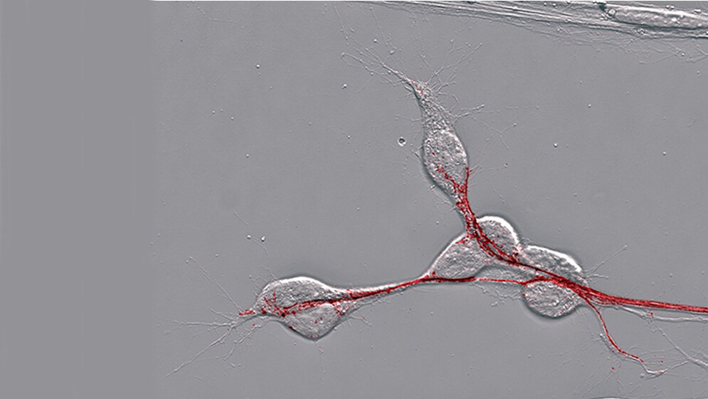 Pionierneuronen_unter_Phasenkontrastmikroskop_TiHo_17082016.jpg Pionierneuronen