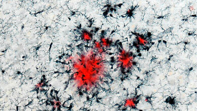 Immunzellen_in_Schwarz_die_sich_rund_um_sogenannte_Plaques_in_Rot_versammelt_haben_DZNE_HIH_Neher.jpg Immunzellen und Plaques