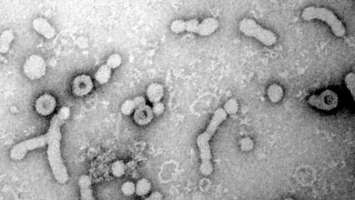 HBV_Elektronenmikroskopische_Aufnahme_nicht_infektioese_Virushuellen_kleine_runde_bzw_laengliche_Uniklinikum_Heidelberg_S_Seitz_21062016.jpg Elektronenmikroskopische Aufnahme von Hepatitis-B-Viren