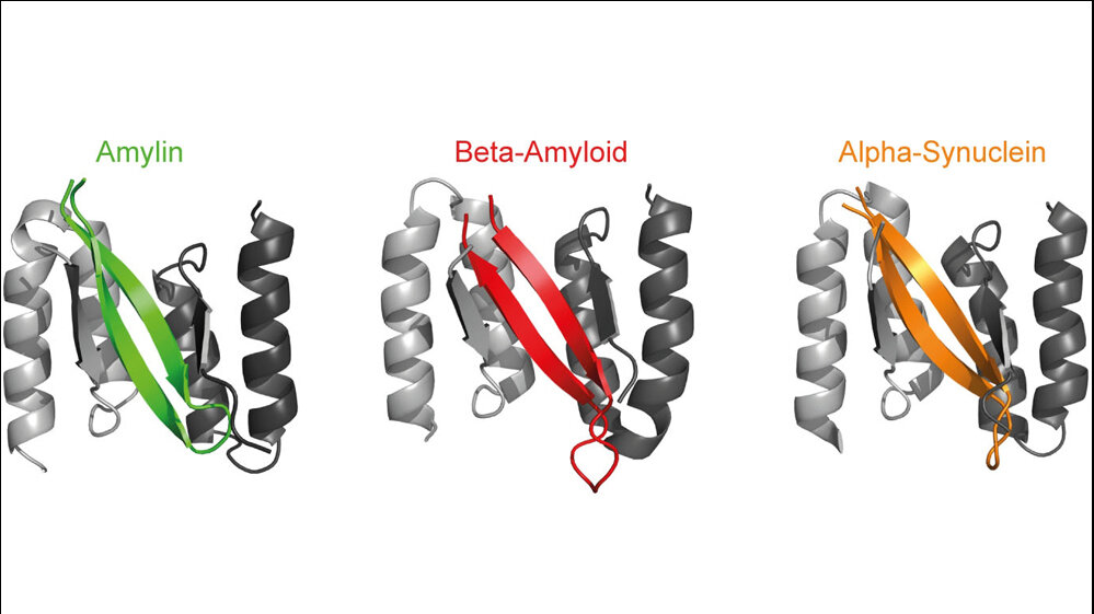 Proteine_Amylin_Beta_Amyloid_Alpha_Synuclein_Wolfgang_Hoyer_HHU.jpg Amylin (grün), Beta-Amyloid (rot) und Alpha-Synuclein