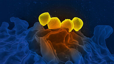 Zunahme von Infektionen durch A-Streptokokken – ein weltweites Problem Aufnahmen gelb gefärbter Streptokokken der Gruppe A (GAS), Streptococcus pyogenes