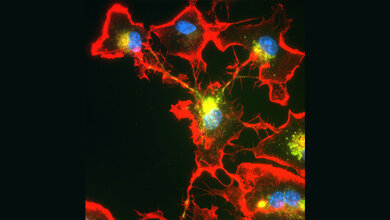 Mikroglia_Zellen_blau_die_Zellkerne_AG_Heneka_Uni_Bonn.jpg Mikroglia-Zellen