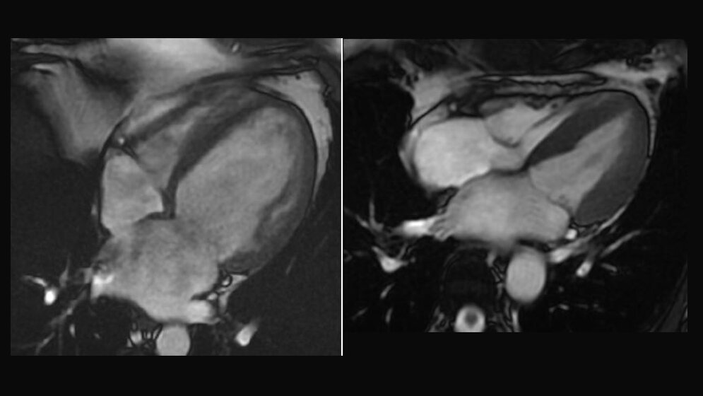 Cardio_MRT_MBq_eigenes_Werk_CC0_wikimedia.jpg Cardio-MRT