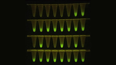 Die_vor_einem_LED_Schirm_fluoreszierenden_Proben_zeigen_Anwesenheit_von_SARS_CoV_2.jpg Die vor einem LED-Schirm fluoreszierenden Proben