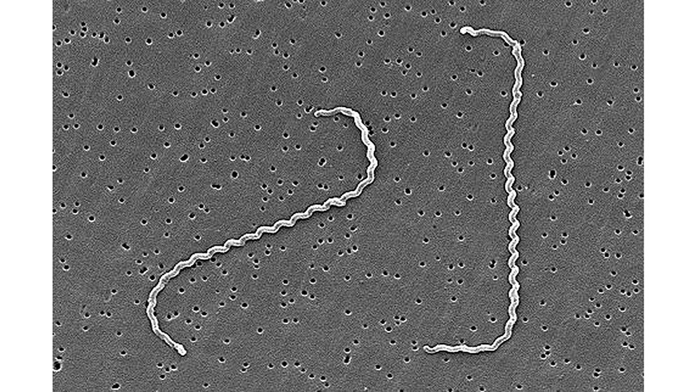 Laboratoriumsmedizin Weil-Krankheit – meldepflichtige Leptospirose