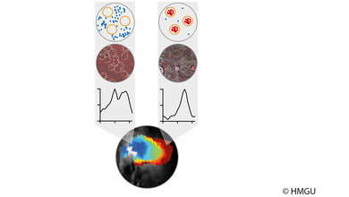 Veraenderung_des_optoakustischen_Signals_phototropher_Bakterien_durch_Aufnahme_von_Makrophagen_HZM.jpg Veränderung des optoakustischen Signals phototropher Bakterien