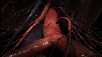 Aorta_www_scientificanimations_com_CC_BY_SA_4_0_via_Wikimedia_Commons.jpg Aorta