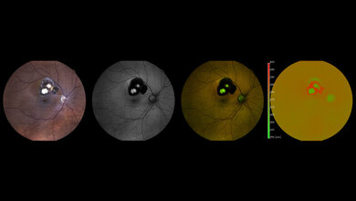 Auge.jpg Augenuntersuchung