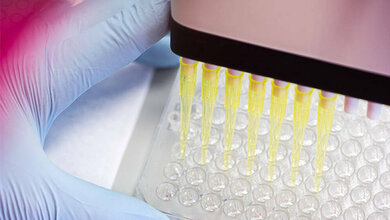 neue_Methode_Antikoerper_fuer_Krebstherapien_identifizieren_A_Hedderrgott_TUM.jpg Neue Methode zur Identifikation von Antikörpern für Krebstherapien