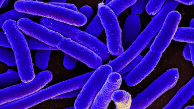 Escherichia_coli_Bakterium_NIAID.jpg Escherichia coli-Bakterium