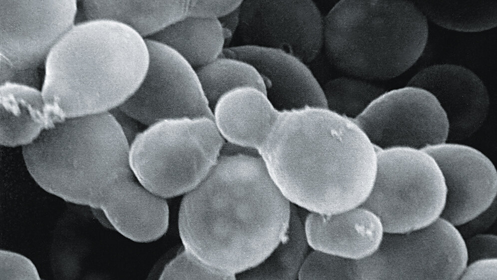 Mikrobiologie Kleienpilzflechte