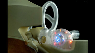 optisches_cochlea_Implantat.jpg Innenohrmodell zum „Hören mit Licht“