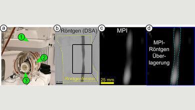 MPI_im_Vergleich.jpg iMPI-Scanner im Vergleich