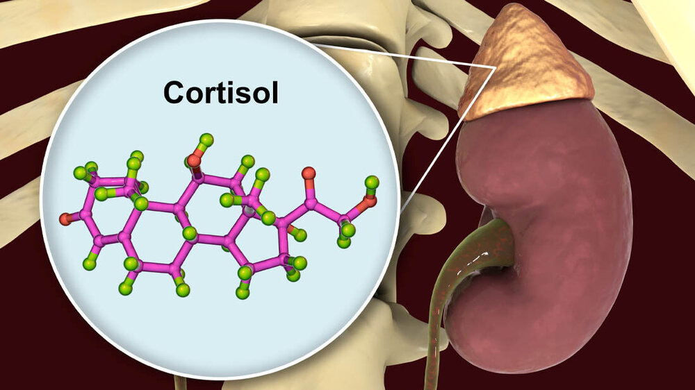 Morbus_Addison.jpg Morbus Addison: Nebenniere und Cortisol sind abgebildet.
