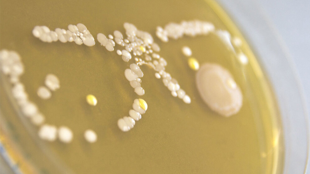 Bakterielle_Besiedlung_der_Rahmen_der_Brille_zeichnet_sich_ab_Theresa_Muehlbauer.jpg Bakterielle Besiedlung