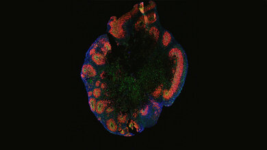 Organoid_der_menschlichen_Grosshirnrinde_Sneha_Arora_MPIMG.jpg Organoid der menschlichen Großhirnrinde