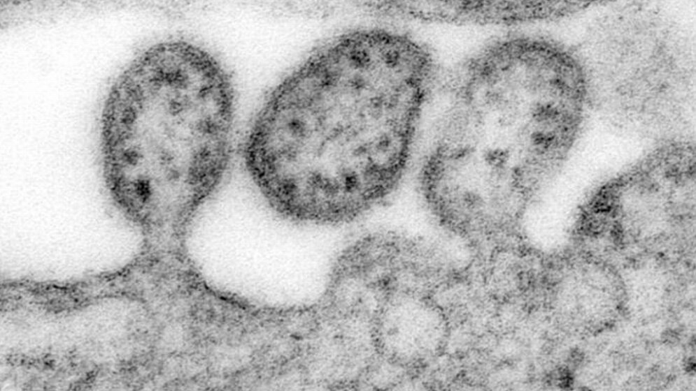 Lassa_virus_virions_TEM_CDC_C_S_Goldsmith_public_domain_18032016.jpg Virion des Lassa-Virus