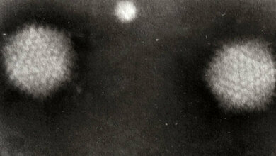 Adenoviruspartikel_GrahamColm_CC_BY_3_0_wikimedia.jpg Adenoviruspartikel