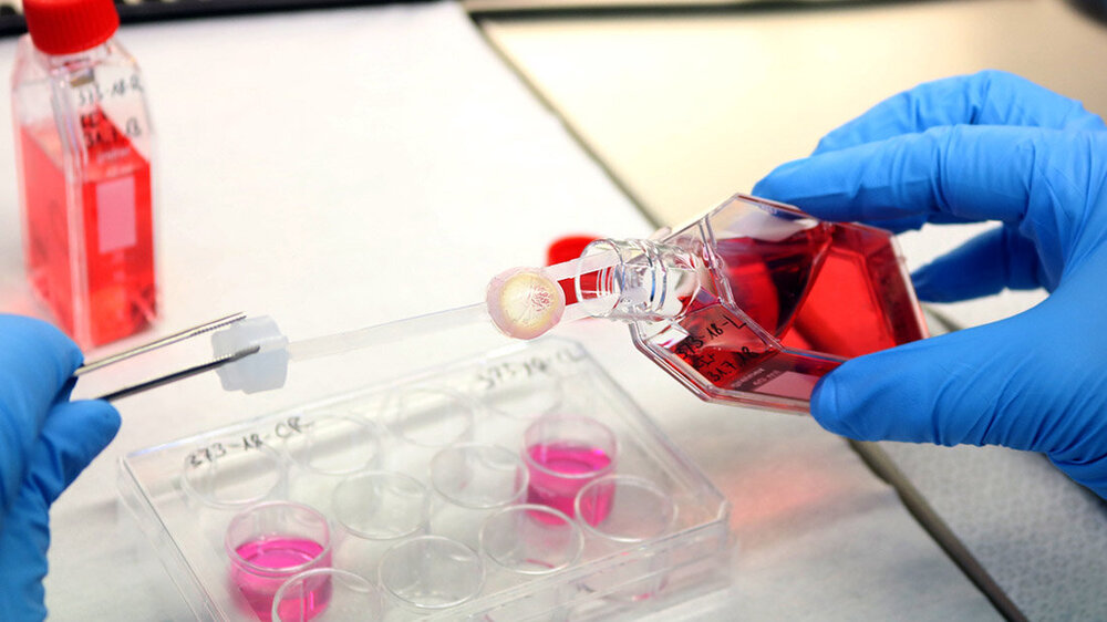 Hornhautprozessierung.jpg Hornhautprozessierung nach Gewebespende.