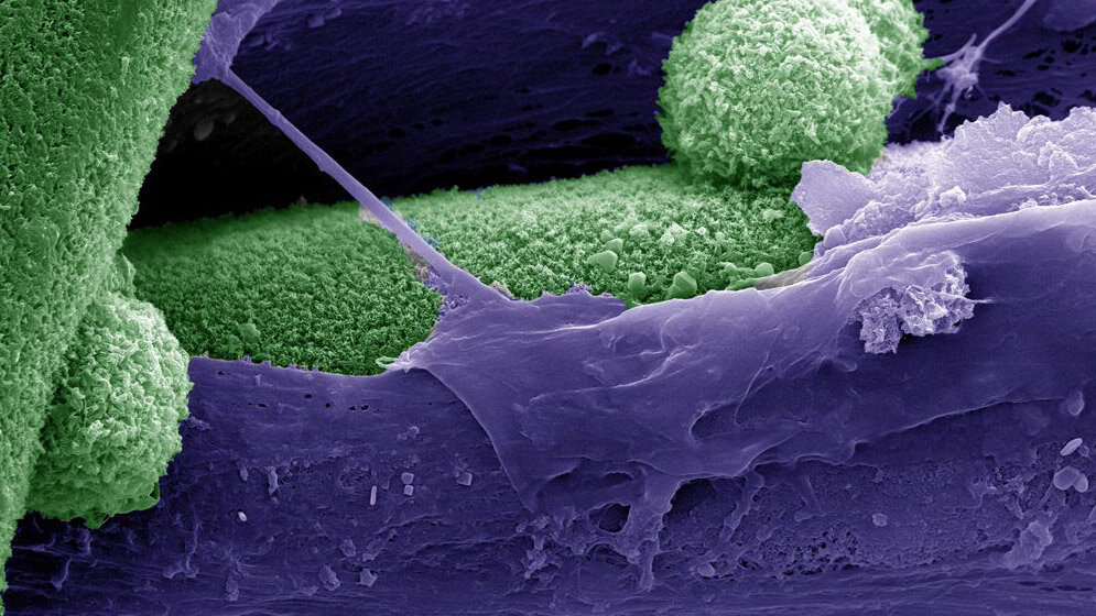 Rasterelektronenmikroskopische_Aufnahme_Die_mineralische_Phase_Uni_Freiburg.jpg Rasterelektronenmikroskopische Aufnahme