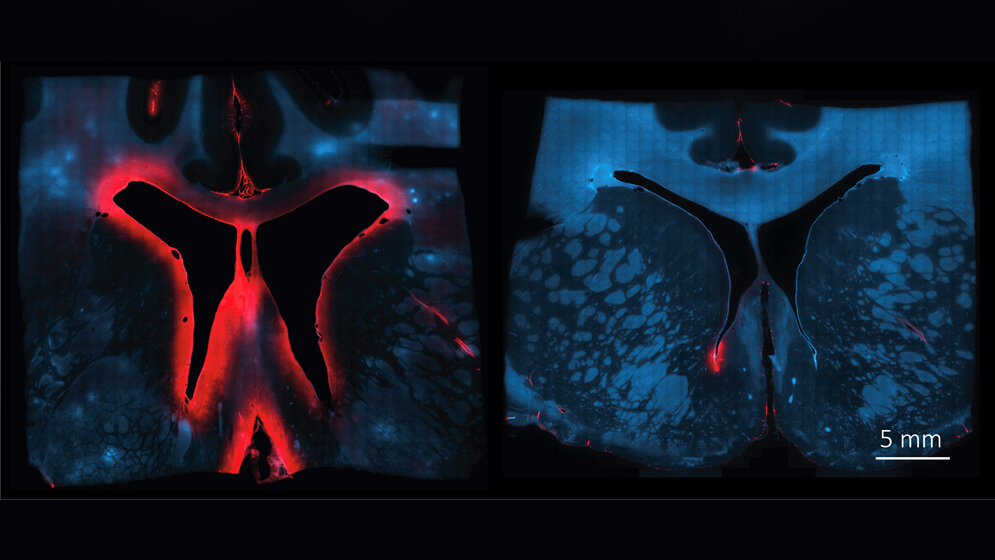 Behandlung_mit_Haptogolbin_Bild_Dominik_Schaer_UZH_USZ.jpg Behandlung mit Haptoglobin