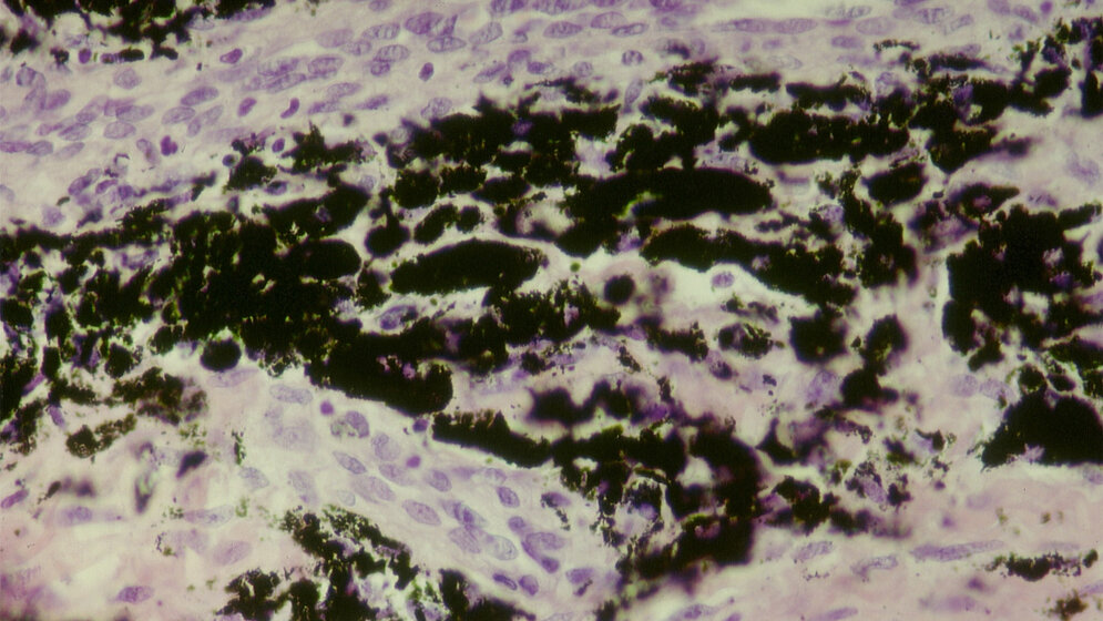 Histologischer_Schnitt_durch_metallotisches_Gewebe_Dr_Bernd_Stengel_Copyrighted_free_use.jpg Histologischer Schnitt durch metallotisches Gewebe