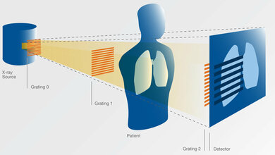 TUM_Dunkelfeld_Bildgebung_mit_Roentgenlicht_ediundsepp_Gestaltungsgesellschaft_TUM.jpg TUM Dunkelfeld-Bildgebung mit Röntgenlicht