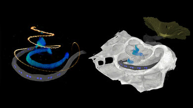 optisches_Cochlea_Implantat_Daniel_Keppeler_UMG.jpg Optisches Cochlea-Implantat