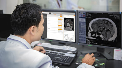 Bildgebende Verfahren Arbeitsentlastung im radiologischen Alltag