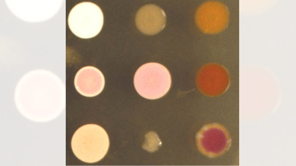 Kolonien_von_Halobacterium_salinarum_Felicitas_Pfeifer_Darmstadt.jpg Kolonien von Halobacterium salinarum