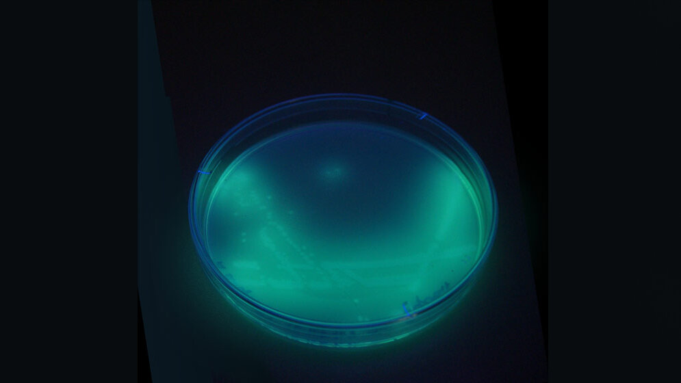 P_aeruginosa_mit_fluoreszierendem_Pigment_unter_UV_Licht_auf_Cetrimidagar_BiotechMichael_Eigenes_Werk_Gemeinfrei_wikimedia.jpg P. aeruginosa