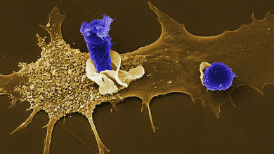 Menschliche_dendritische_Zelle_tauscht_Informationen_aus_HZI_Manfred_Rohde.jpg Eine menschliche dendritische Zelle