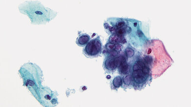 Laboratoriumsmedizin Repetitorium: Methoden der Zellkultur