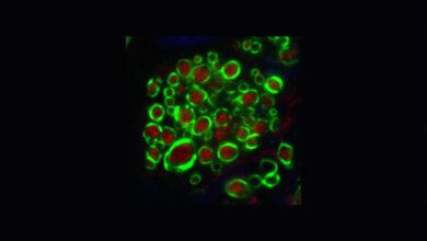 Querschnitte_von_Nervenfasern_des_Trapezkoerpers_und_isolierende_Myelinschicht_J_Sinclair_C_Kopp_Scheinpflug_LMU.jpg Trapezkörper und Myelinschicht