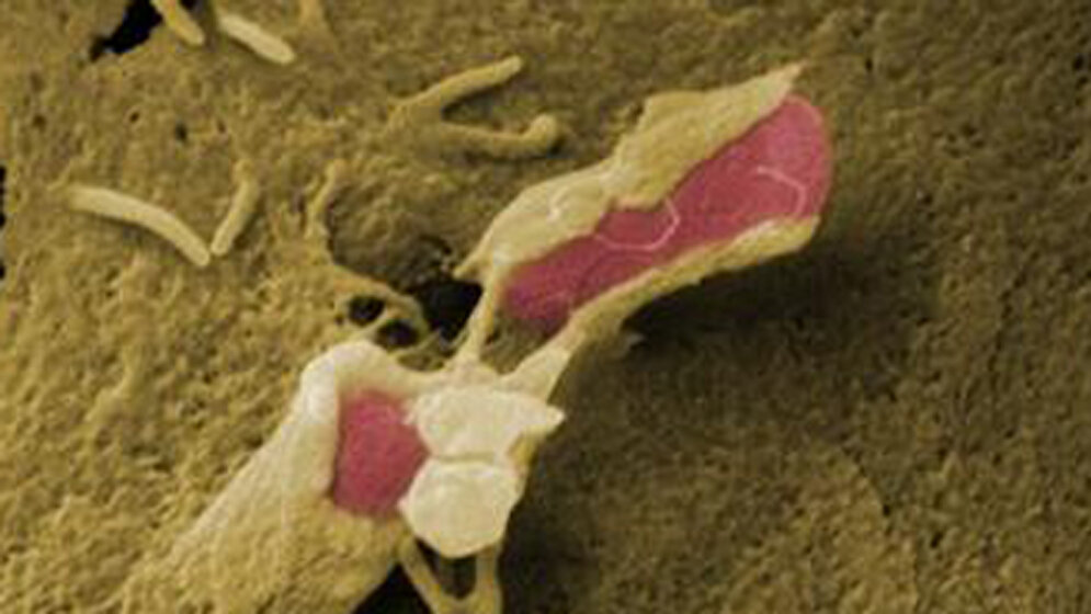 newsimage.jpg-bakterien.jpg Bakterien