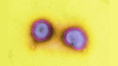 Influenza_Viren_Quelle_Boller_Paul_Ehrlich_Institut.jpg Influenza-Viren