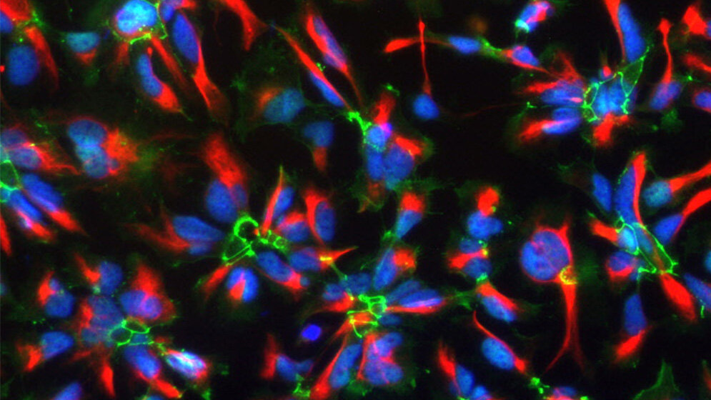 humane_neurale_Stammzellen_Bruestle_Uni_Bonn_09082016.jpg humane neurale Stammzellen