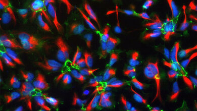 humane_neurale_Stammzellen_Bruestle_Uni_Bonn_09082016.jpg humane neurale Stammzellen