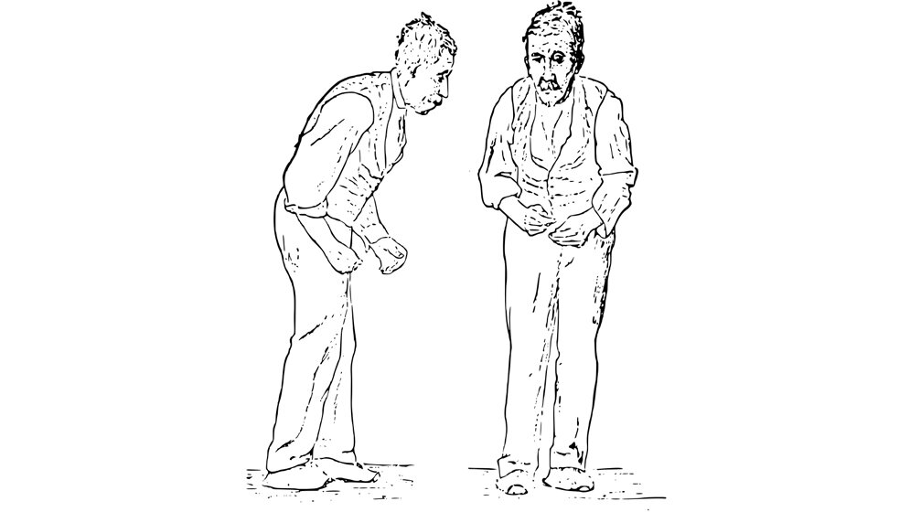 Illustration_der_Parkinson_Krankheit_Sir_William_Richard_Gowers_Parkinson_Disease_sketch_1886_Gemeinfrei_wikimedia.jpg Illustration der Parkinson Krankheit