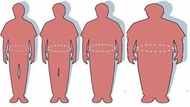 Obesity_Mike_Licht_CC_BY_2_01042016.jpg Adipositas