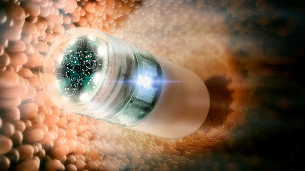 Endoskopie_Kapsel_zur_Duenndarm_Diagnose_Fraunhofer_IZM_Volker_Mai.jpg Endoskopie-Kapsel