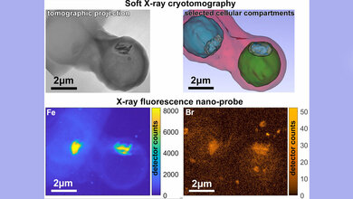 Messmethoden_an_den_Synchrotronquellen_BESSY_II_ALBA_und_ESRF_S_Kapishnikov.jpg Kombination mehrerer Messmethoden an den Synchrotronquellen BESSY II, ALBA und ESRF