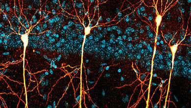 Neurone.jpg Neuronales Signalosom als Schlüssel zur Behandlung der Alzheimer-Krankheit erforscht