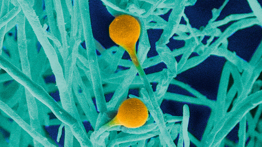 Mikrobiologie Schimmelpilze Teil 3: Mucor