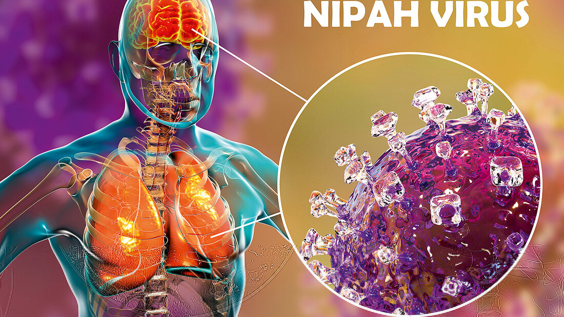Nipah-Virus-Infektion Titelbild für den Fachbeitrag über die Nipah-Virus-Infektion