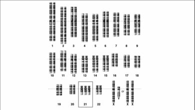 Trisomie21_Courtesy_National_Human_Genome_Research_Institute_Gemeinfrei_19102016.jpg Schema des Genoms bei freier Trisomie 21