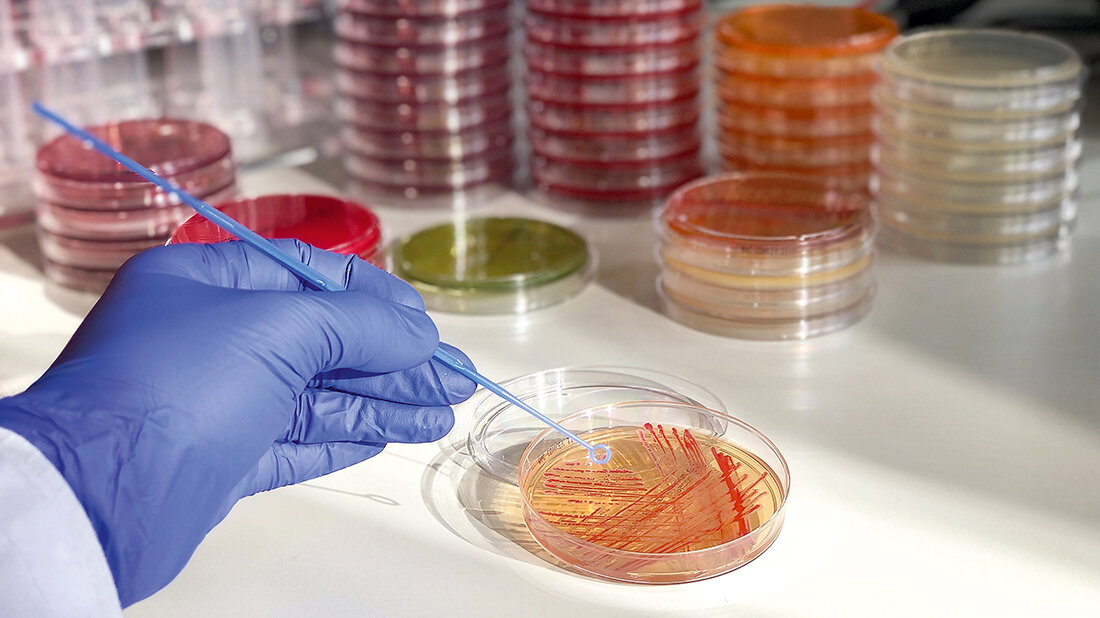 Carbapenem resistente Enterobacterales Titelbild zum Fachbeitrag „Carbapenem resistente Enterobacterales“