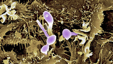 Candida_albicans_violett_auf_Epithelzellen_Bernhard_Hube_Leibniz_HKI.jpg Candida albicans